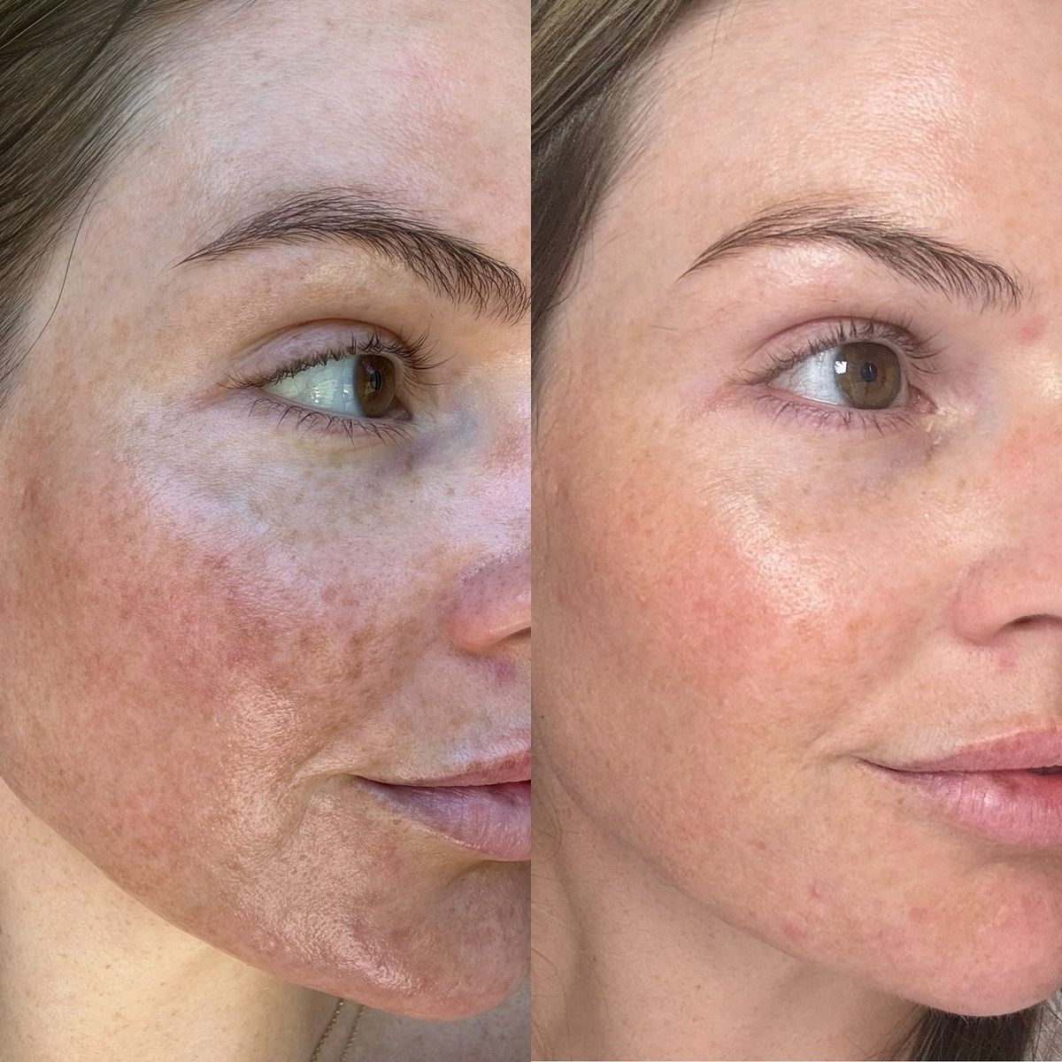 Des résultats visibles, jour après jour 🌸